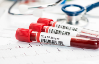 Blood Tests in India: Importance, Types & Benefits | HealthChek Pathology Services