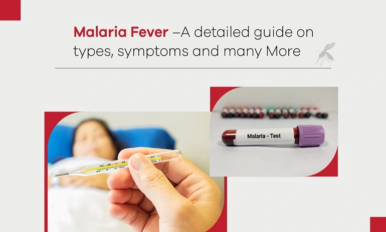 Malaria Fever – A Detailed Guide on Types, Symptoms and Many More