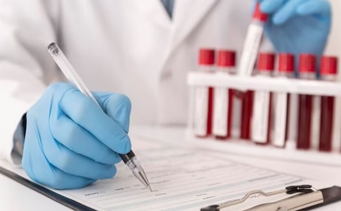 Top 10 Preventive Lab Tests You Shouldn’t Ignore After 30