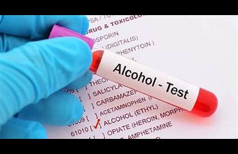 Alcohol Test: Purpose, Types, and What to Expect