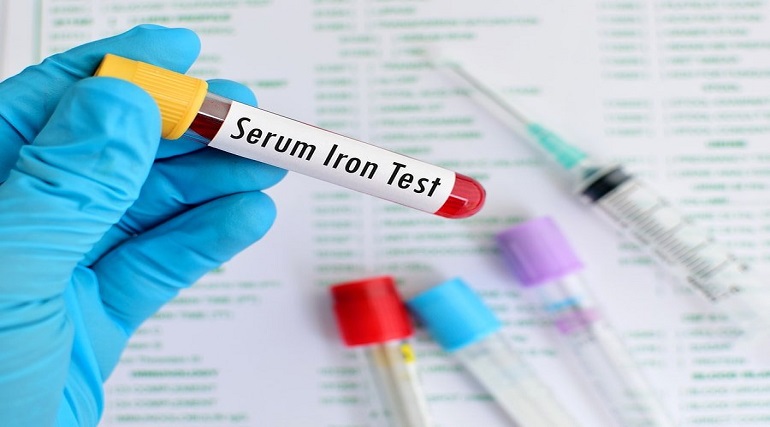 Iron Test: What It Is, Purpose, Procedure & Results Your Guide to Iron Tests