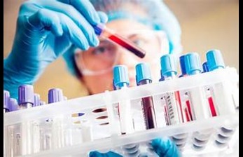 Understanding Lab Tests: Your Guide to Better Health