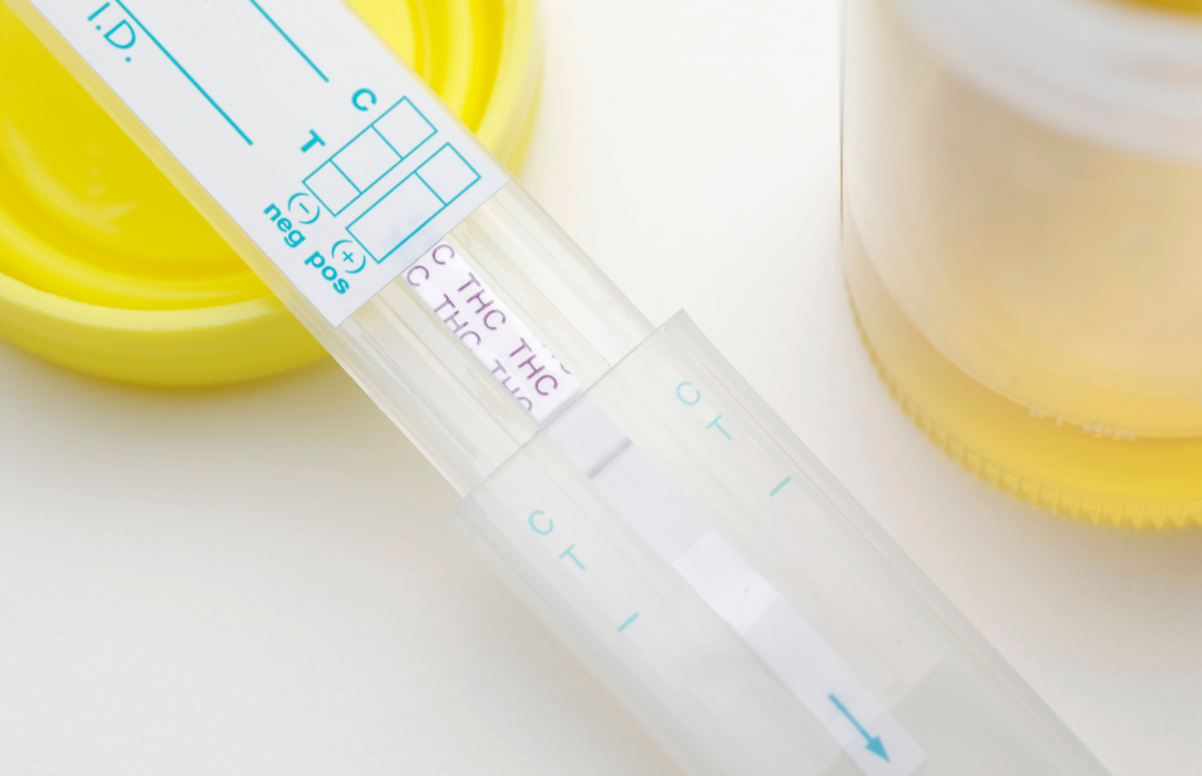 Urine Drug Test Services in India | Workplace Drug Testing by HealthChek