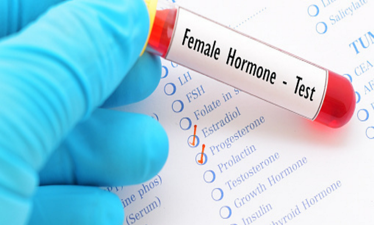 Female Hormone Profile Test