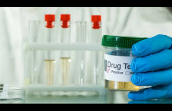 A Complete Guide to Drug Testing: Methods, Importance, and FAQs