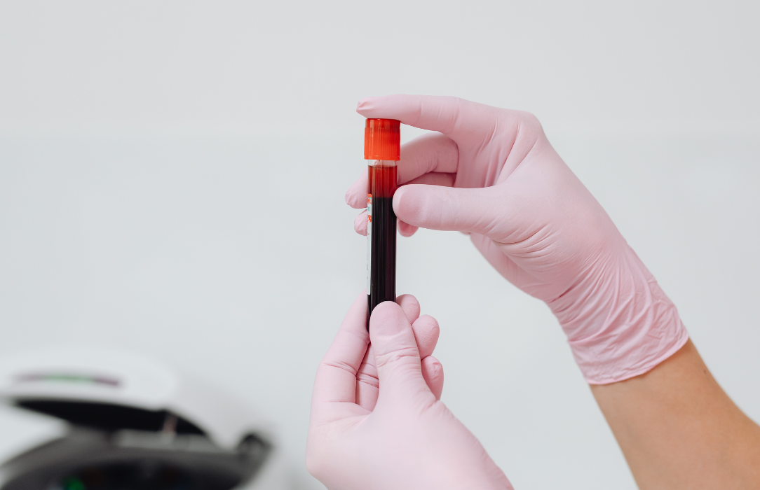 Blood Tests – Comprehensive Pathology Services by HealthChek
