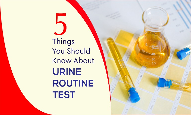 5 Things You Should Know About Urine Routine Test