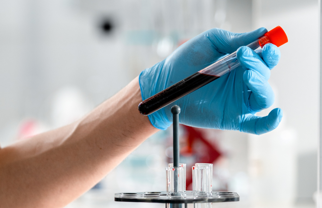 Blood Tests: Accurate & Reliable Pathology Services