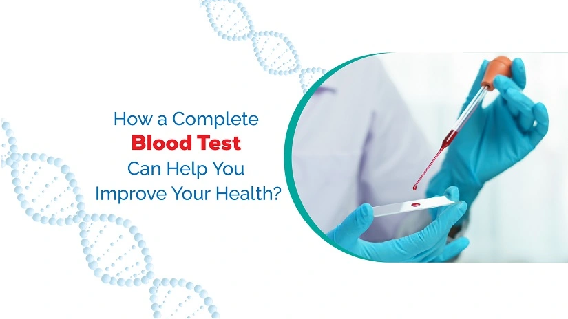 How a Complete Blood Test Can Help You Improve Your Health?