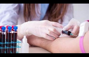 Blood Test: Purpose, Types, Procedure & Results