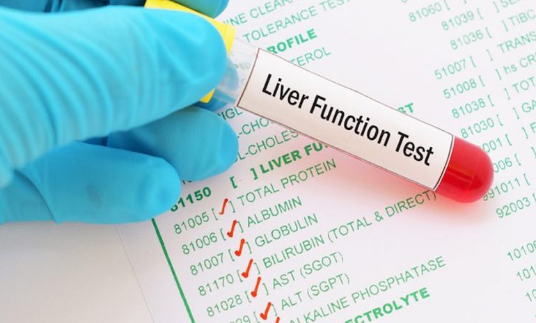 Liver Function Tests
