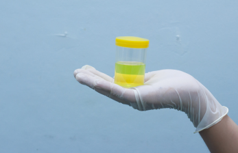 Best Shipping Medical Test Center in Delhi NCR | OEUK Medical HealthChek