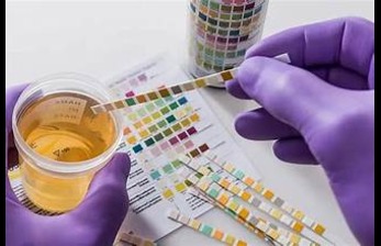 Urine Drug Test: Everything You Need to Know