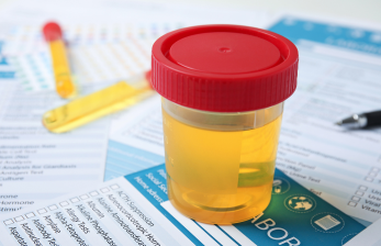 Urine Drug Test – Reliable and Certified Drug Testing Services by HealthChek India