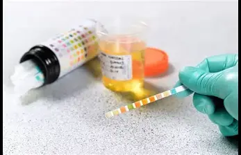 Drug Testing: Ensuring Safety, Wellness, and Accountability