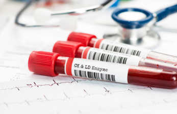 Comprehensive Lab Tests in India | OEUK Medical HealthChek