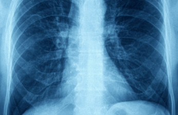 ILO Medical Examination — Fitness Test for Offshore & Industrial Workers