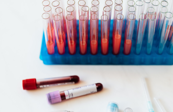 Comprehensive Blood Tests in India | OEUK Medical HealthChek