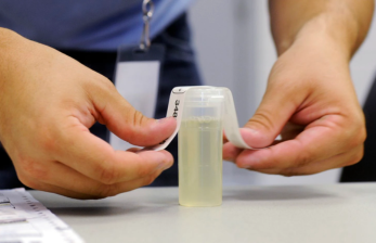 Urine Drug Test — Purpose, Procedure, Accuracy & Preparation