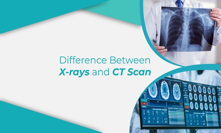 Difference between X-rays and CT scans