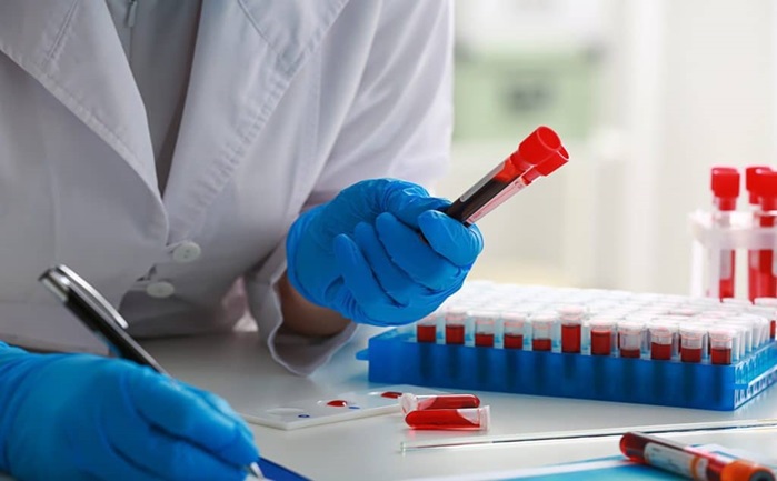 Essential Blood Tests to Check Your Nutrient Levels