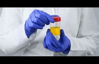 Urine Drug Test: Purpose, Procedure, and What to Expect