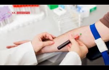 Blood Test Near Me – Quick and Accurate Diagnostic Services for Better Health
