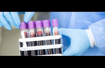 Blood Tests: The Key to Understanding Your Body’s Inner Health