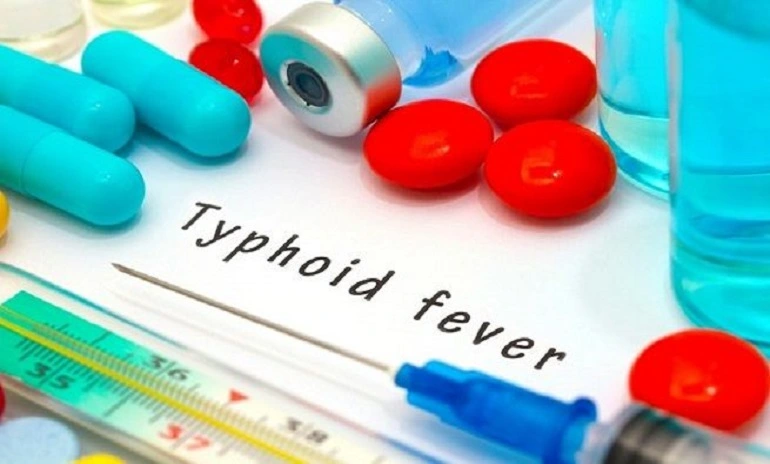 Everything You Need To Know About Typhoid Fever